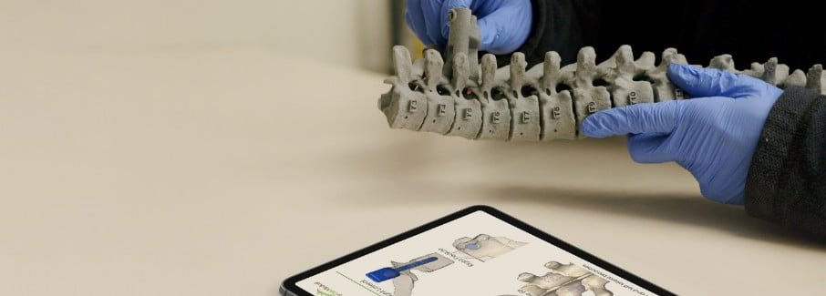 3d printed anatomical model of a spine by Mighty Oak Medical
